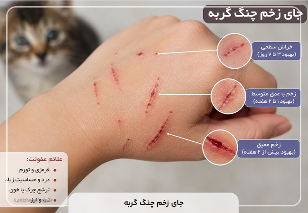 جای زخم چنگ گربه